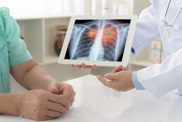 New Protection Against Lung Cancer